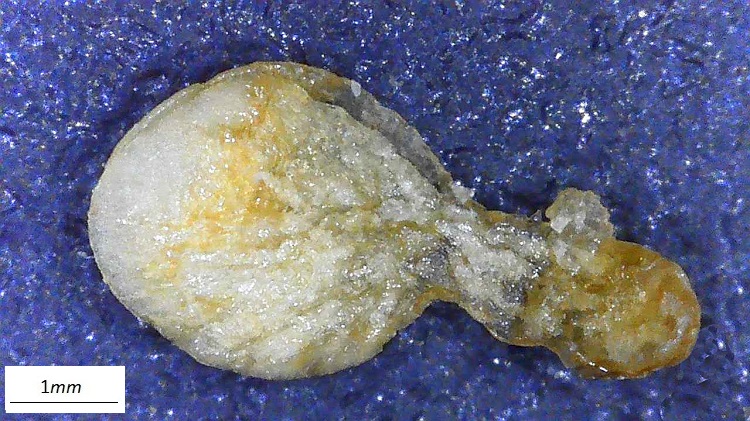 Dove si parla di una pianta della macchia mediterranea difficilmente distinguibile dalla sorella a foglia sottile. E se ne descrivono i caratteri dal portamento all'embrione.